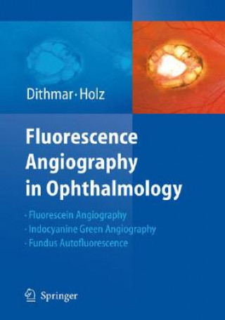 Carte Fluorescence Angiography in Ophthalmology Stefan Dithmar