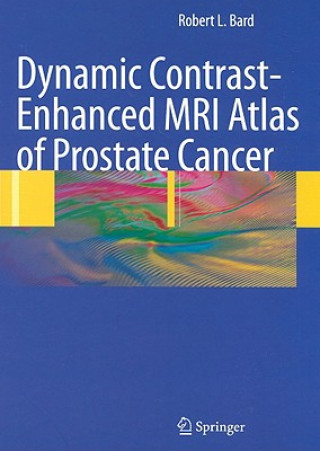 Carte Dynamic Contrast-Enhanced MRI Atlas of Prostate Cancer Robert L. Bard