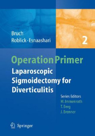 Könyv Laparoscopic Sigmoidectomy for Diverticulitis Hans-Peter Bruch