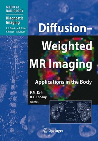 Kniha Diffusion-Weighted MR Imaging Dow-Mu Koh