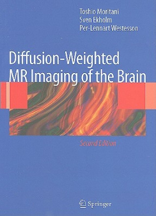 Kniha Diffusion-Weighted MR Imaging of the Brain Toshio Moritani