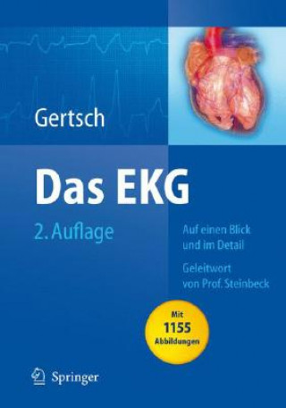 Carte Das EKG Marc Gertsch