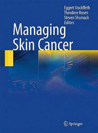 Book Managing Skin Cancer Eggert Stockfleth