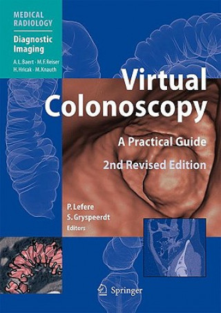 Kniha Virtual Colonoscopy Philippe Lefere