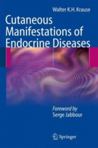 Carte Cutaneous Manifestations of Endocrine Diseases Walter K.H. Krause