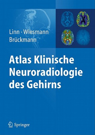 Carte Atlas Klinische Neuroradiologie des Gehirns Jennifer Linn