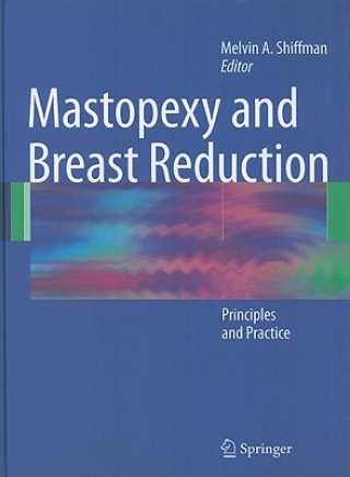 Carte Mastopexy and Breast Reduction Melvin A. Shiffman