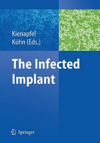 Könyv Infected Implant Heino Kienapfel
