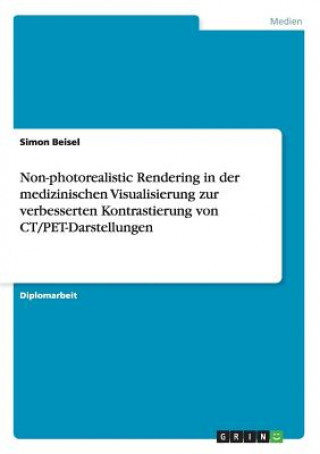 Kniha Non-photorealistic Rendering in der medizinischen Visualisierung zur verbesserten Kontrastierung von CT/PET-Darstellungen Simon Beisel