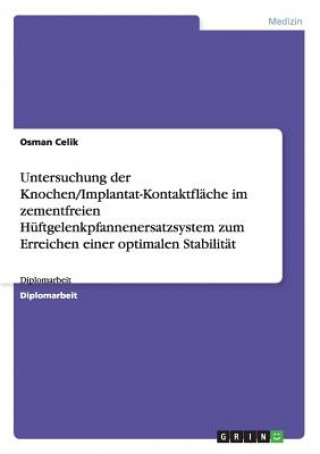 Книга Untersuchung der Knochen/Implantat-Kontaktflache im zementfreien Huftgelenkpfannenersatzsystem zum Erreichen einer optimalen Stabilitat Osman Celik