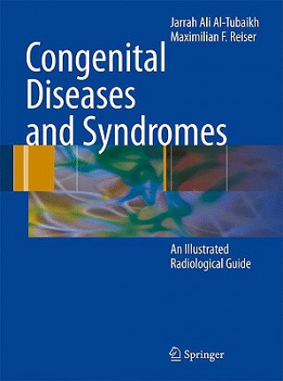 Carte Congenital Diseases and Syndromes Jarrah A. Al-Tubaikh