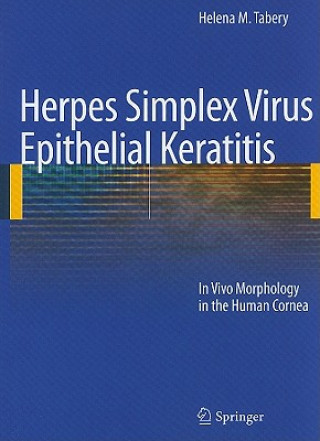 Kniha Herpes Simplex Virus Epithelial Keratitis Helena M. Tabery