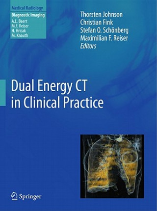 Carte Dual Energy CT in Clinical Practice Thorsten Johnson
