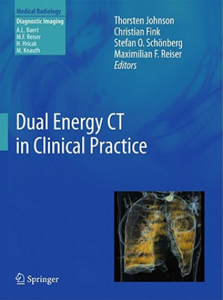 Knjiga Dual Energy CT in Clinical Practice Thorsten Johnson