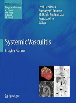 Книга Systemic Vasculitis Lotfi Hendaoui