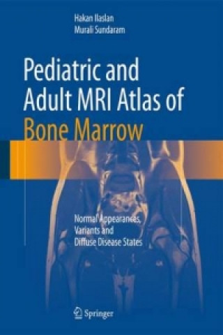 Kniha Pediatric and Adult MRI Atlas of Bone Marrow Hakan Ilaslan