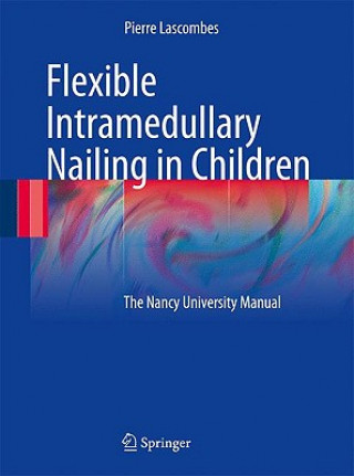 Книга Flexible Intramedullary Nailing in Children Pierre Lascombes