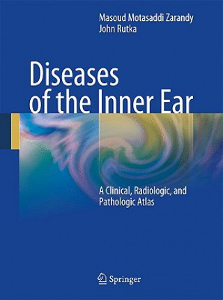 Kniha Diseases of the Inner Ear Masoud M. Zarandy