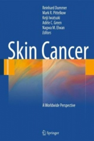 Könyv Skin Cancer - A World-Wide Perspective Reinhard Dummer