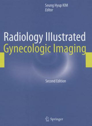 Carte Radiology Illustrated: Gynecologic Imaging Seung Hyup Kim