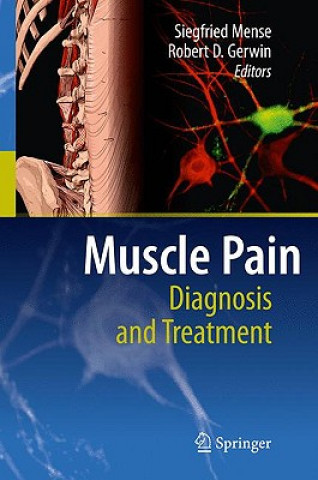 Könyv Muscle Pain: Diagnosis and Treatment Siegfried Mense