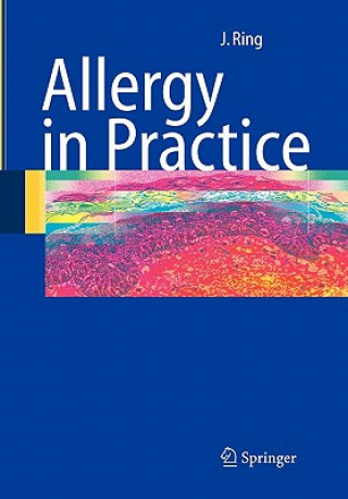 Book Allergy in Practice Johannes Ring