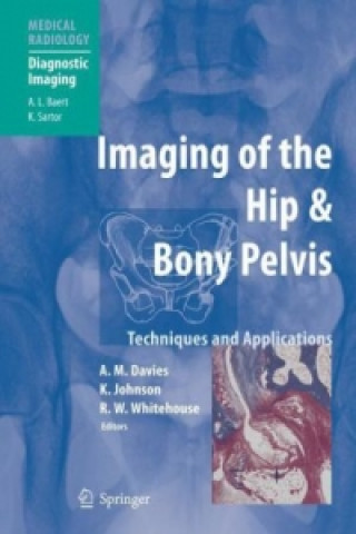 Книга Imaging of the Hip & Bony Pelvis A. Mark Davies