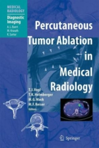 Kniha Percutaneous Tumor Ablation in Medical Radiology Thomas J. Vogl