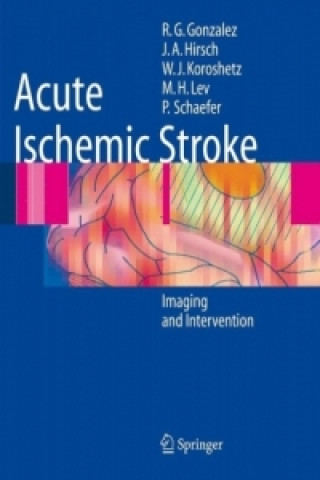 Könyv Acute Ischemic Stroke R. Gilberto González