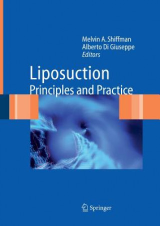 Könyv Liposuction Melvin A. Shiffman