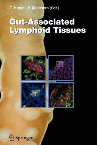 Carte Gut-Associated Lymphoid Tissues Tasuku Honjo