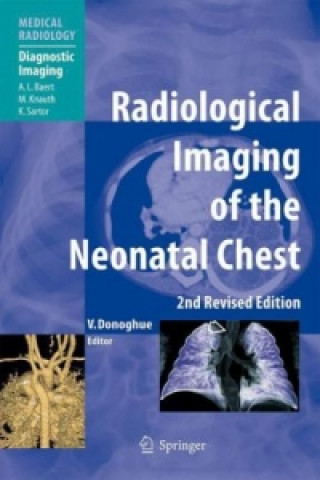 Könyv Radiological Imaging of the Neonatal Chest Veronica B. Donoghue