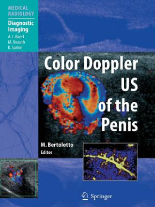 Книга Color Doppler US of the Penis Michele Bertolotto