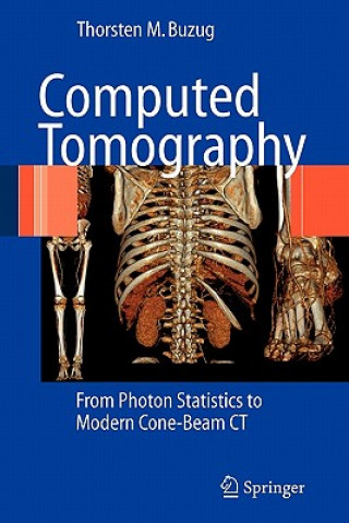 Kniha Computed Tomography Thorsten M. Buzug