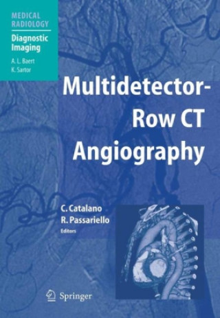 Kniha Multidetector-Row CT Angiography Roberto Passariello