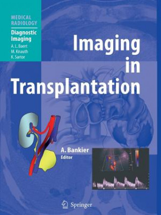 Kniha Imaging in Transplantation Alexander A. Bankier