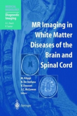 Könyv MR Imaging in White Matter Diseases of the Brain and Spinal Cord Massimo Filippi