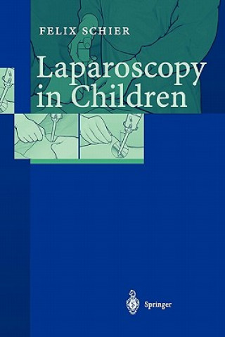 Kniha Laparoscopy in Children Felix Schier