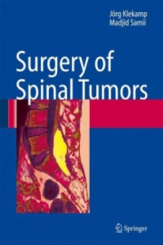 Kniha Surgery of Spinal Tumors Jörg Klekamp