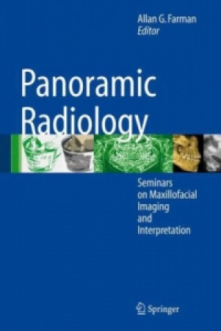 Carte Panoramic Radiology Allan G. Farman