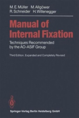 Buch Manual of INTERNAL FIXATION Maurice E. Müller