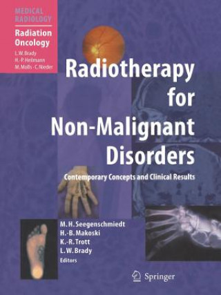 Книга Radiotherapy for Non-Malignant Disorders Michael Heinrich Seegenschmiedt