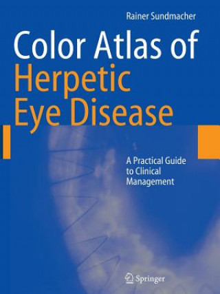 Libro Color Atlas of Herpetic Eye Disease Rainer Sundmacher