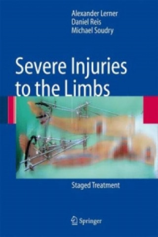 Knjiga Severe Injuries to the Limbs Alexander Lerner