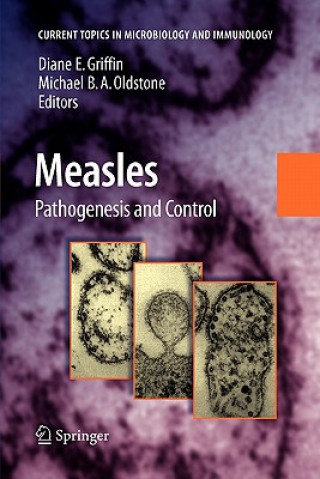 Libro Measles Diane E. Griffin