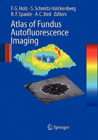 Libro Atlas of Fundus Autofluorescence Imaging Frank G. Holz