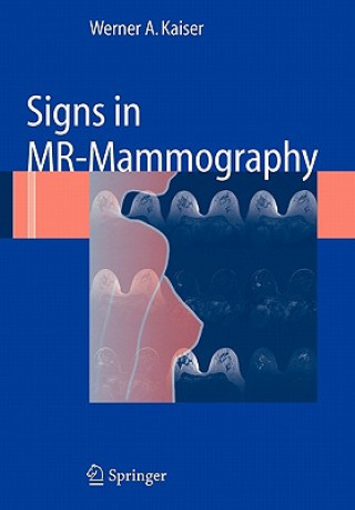 Książka Signs in MR-Mammography Werner A. Kaiser