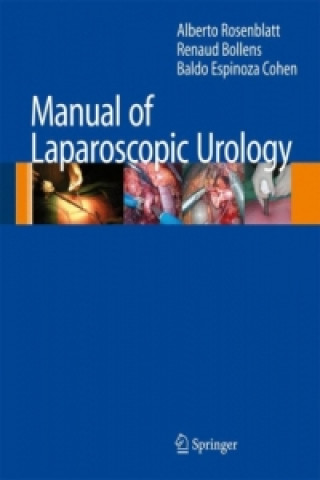 Carte Manual of Laparoscopic Urology Alberto Rosenblatt