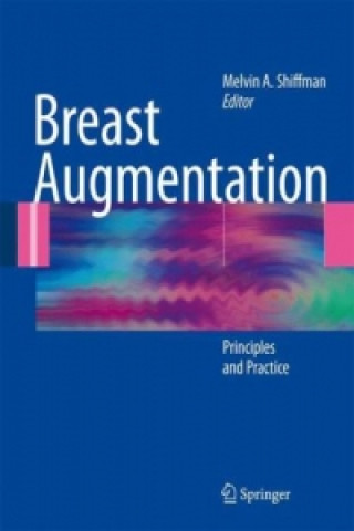 Kniha Breast Augmentation Melvin A. Shiffman