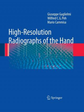 Kniha High-Resolution Radiographs of the Hand Giuseppe Guglielmi